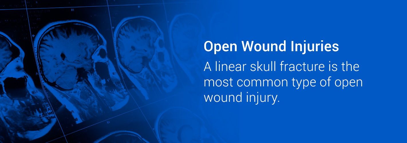 Open Wound Injuries