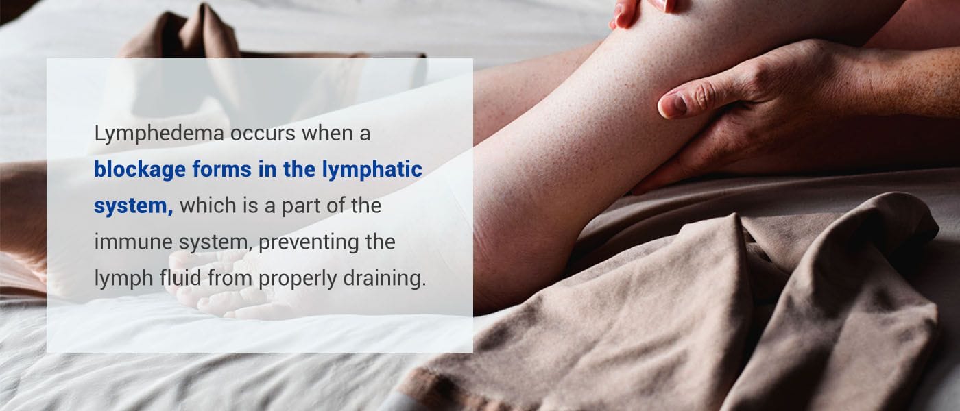 01-lymphedema-symptoms.jpg