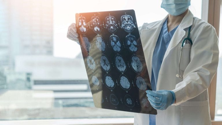 Specialized Care Critical for Brain Injury Recovery