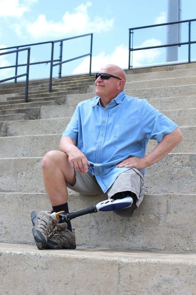 man with prosthetic leg sitting outside smiling